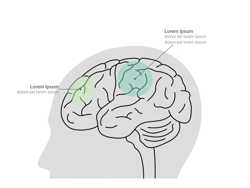 Create Brain Chart