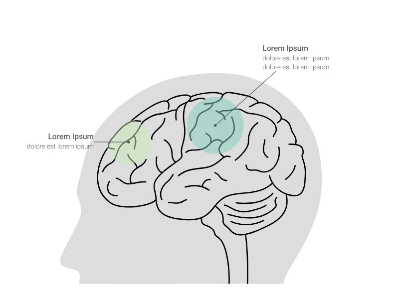 Brain Chart preview